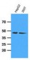 ADK / Adenosine Kinase Antibody (clone AT4F8)